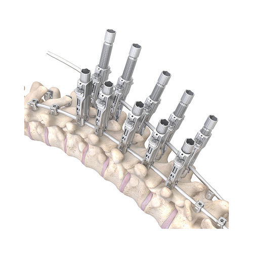 Thorako-lumbales Stabilisierungssystem für Osteosynthese - RESPONSE™ 5.5/6.0 - OrthoPediatrics - dorsaler Zugang / für Kinder