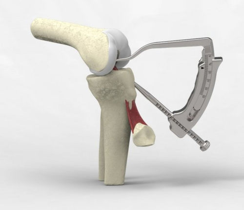 Instrumentenset / Rekonstruktion des vorderen Kreuzbandes - NeoSys Medical Solutions