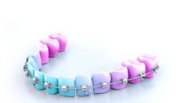 Kieferorthopädischer Draht / NiTi - BIO ACTIVE LIGHT - GC Orthodontics