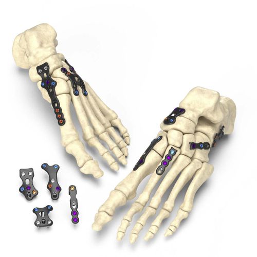 Arthrodeseplatte für Rückfuß - Stratum® - Nextremity Solutions - für Vorfuß / mit Verriegelung