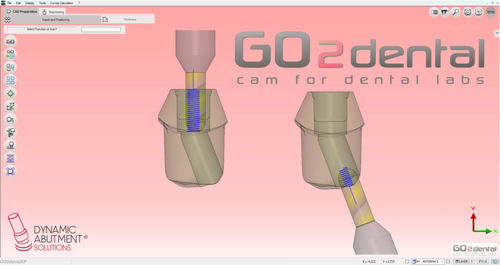 Software für Dentallabor - GO2dental - Dynamic Abutment Solutions - FAO