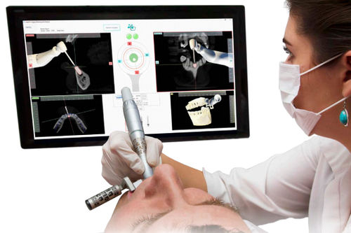 Chirurgisches Navigationssystem / für Zahnchirurgie - Inliant Dental Technologies Inc. - optisch