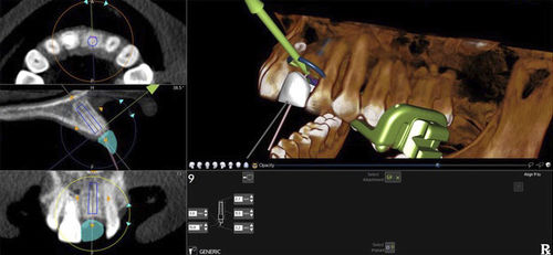 Anatomie-Software - X-Guide - X-Nav Technologies - Computertomographie / Planung / Import