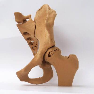 Anatomisches Modell / Knochen - 3D Lifeprints UK Ltd - Becken / Hüfte / Ausbildung