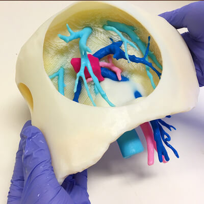 Anatomisches Modell / Leber - 3D Lifeprints UK Ltd - Arterie / Vene