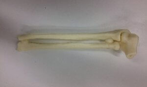 Anatomisches Modell / Knochen - 3D Lifeprints UK Ltd - Radius / Elle / Ellbogen