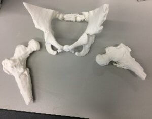 Anatomisches Modell / Knochen - 3D Lifeprints UK Ltd - Becken / Oberschenkelknochen / Chirurgie