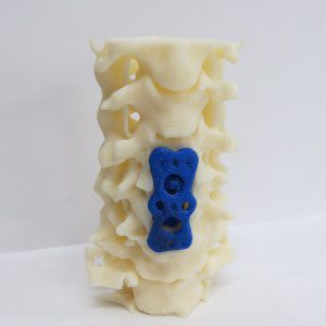 Lendenwirbelsäule anatomisches Modell - 3D Lifeprints UK Ltd - für Wirbelsäulenchirurgie