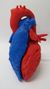 Anatomisches Herzmodell - 3D Lifeprints UK Ltd - für die Herzchirurgie