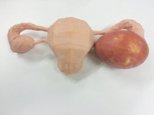Anatomisches Modell / Ovarien - 3D Lifeprints UK Ltd - für Roboterchirurgie / für Ovariohysterektomie