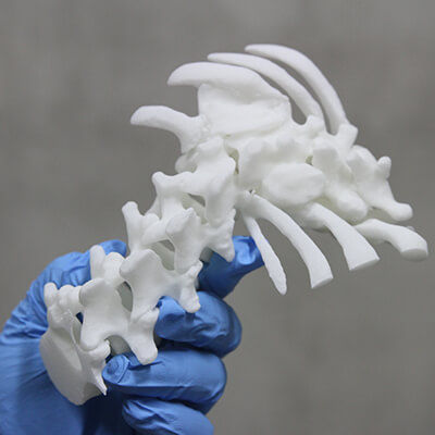 Anatomisches Modell / Wirbelsäule - 3D Lifeprints UK Ltd - für Skoliose