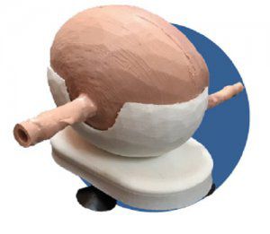 Anatomisches Modell / Blase - 3D Lifeprints UK Ltd - für Endoskopie