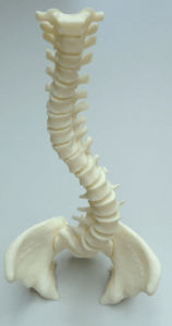 Anatomisches Modell / Wirbelsäule - 3D Lifeprints UK Ltd - für Skoliose