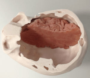 Anatomisches Schädelmodell - 3D Lifeprints UK Ltd - Gehirn / für Kraniotomie
