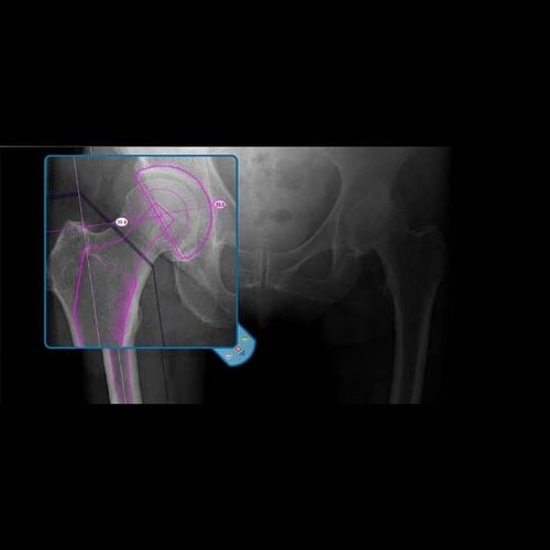 Medizinische Software - OrthoView - Materialise UK - für Kliniken / für Chirurgie / Analyse