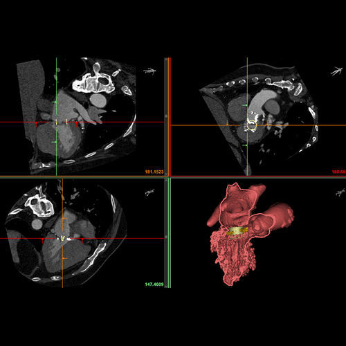 3D-Visualisierung-Software - Mimics Enlight - Materialise UK - medizinisch / Anatomie / Computertomographie