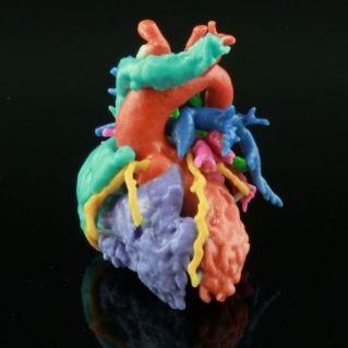 3D-Druck-Software - HeartPrint - Materialise UK - Planung / medizinisch / Anatomie