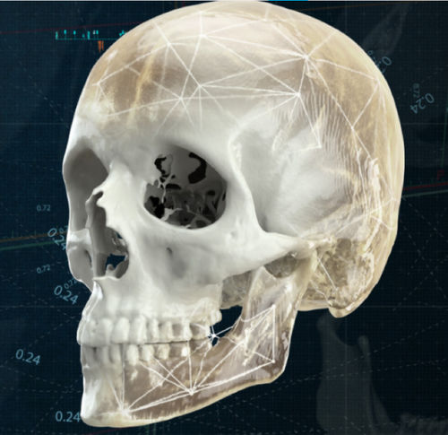 3D-Visualisierung-Software - CMF - Materialise UK - medizinisch / für Krankenhaus / für Kliniken