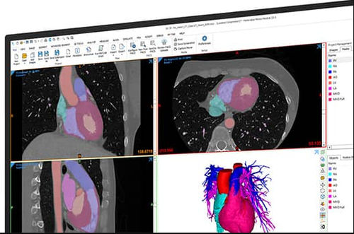 Viewer-Software - Mimics  - Materialise UK - medizinisch / für Kliniken / Management