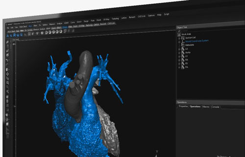 3D-Visualisierung-Software - 3-matic  - Materialise UK - medizinisch / Anatomie / Projektentwicklung