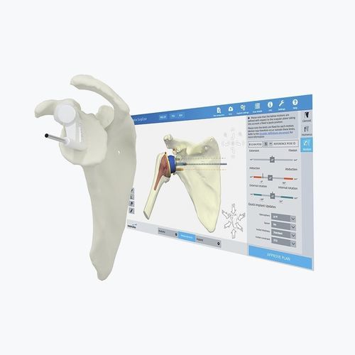 Medizinische Software - Materialise UK - Anatomie / Computertomographie / OP