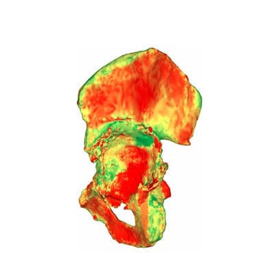 Medizinische Software - aMace - Materialise UK - für Kliniken / Computertomographie / für Chirurgie