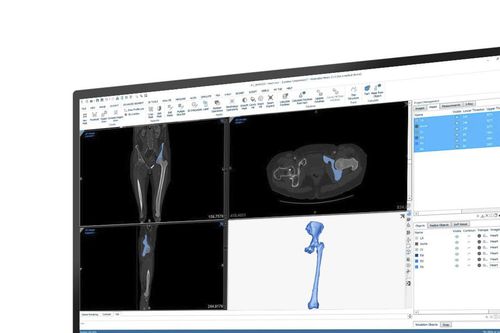 Medizinische Software - Mimics - Materialise UK - für Kliniken / Anatomie / Mess