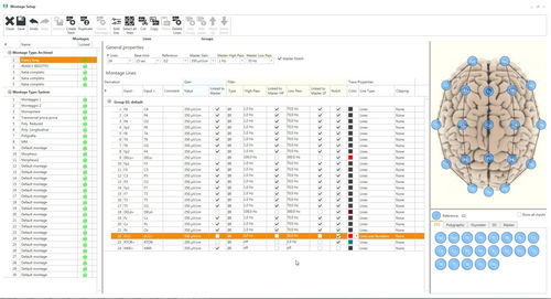 Analysesoftware - Micromed Italy - Datenanalyse / Management / Monitoring
