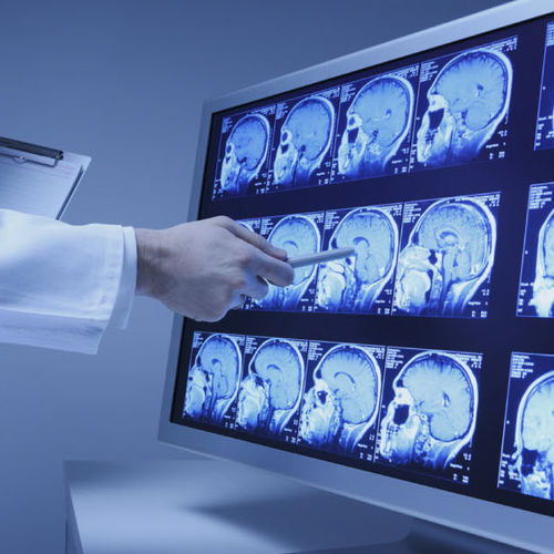 Analyse-RIS - SinoVision - für medizinische Bildgebung / Herz / für Krankenhaus