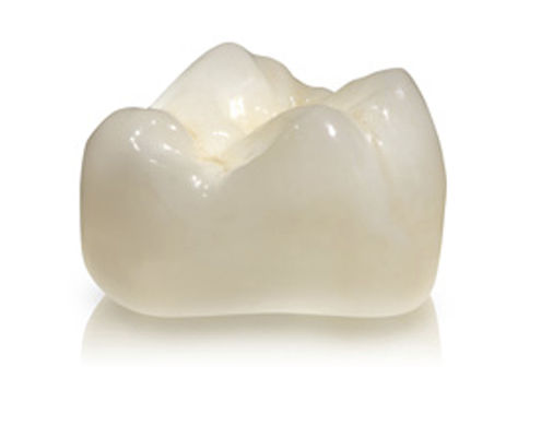 Zirkonoxid-Zahnkrone - DIAMOND - Derby Dental - für Seitenzähne / lichtdurchlässig