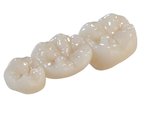Zirkonoxid-Zahnbrücke - DIAMOND - Derby Dental - für Seitenzähne / lichtdurchlässig