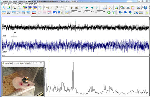 Analysesoftware - EEG+ - emka TECHNOLOGIES - Aufzeichnung / medizinisch / für EMG