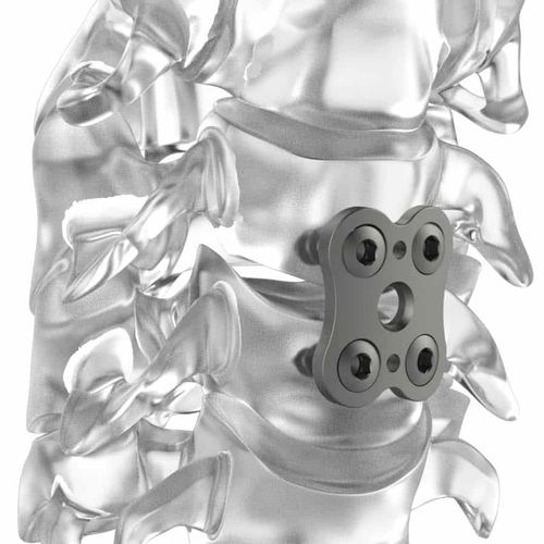 HWS-Arthrodeseplatte - PM BUTTERFLY® - NEURO FRANCE Implants - mit Verriegelung / Titan / 2 Ebenen