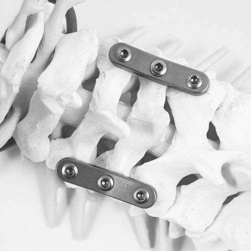 Arthrodeseplatte für Halswirbel - STABILAR® PCP - NEURO FRANCE Implants - ohne Verriegelung / Titan