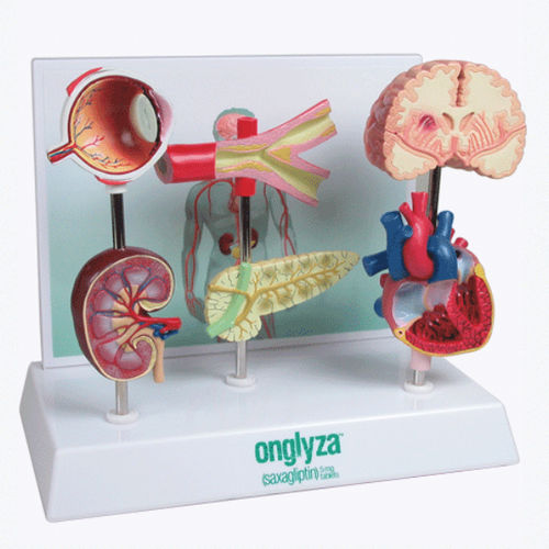 Anatomisches Modell / für Diabetes - A575 - Apple Biomedical - Herz / Arterie / Auge