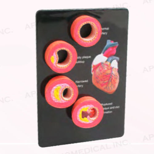 Anatomisches Modell / Handgerät - A534 - Apple Biomedical - Arterie / für die Ausbildung / rosa