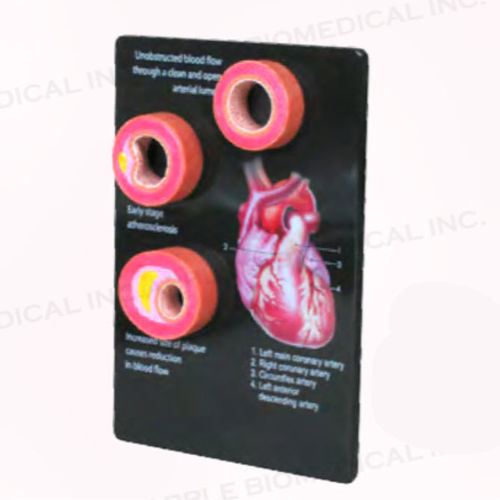 Anatomisches Modell / Arterie - A520 - Apple Biomedical - für die Ausbildung / rosa / Handgerät