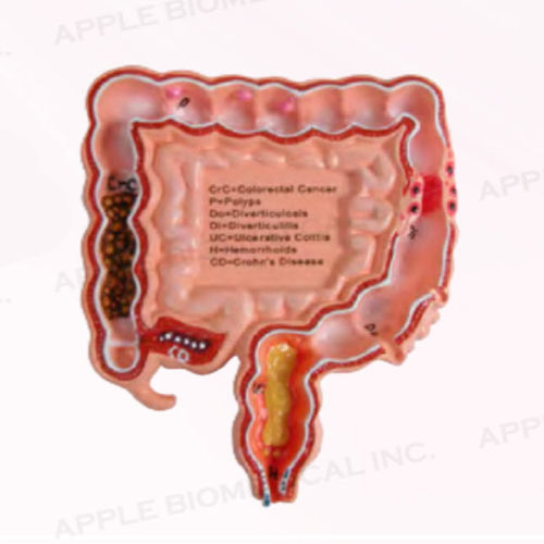 Anatomisches Kolonmodell - A345 - Apple Biomedical - für Gastroenterologie / für die Ausbildung / rosa