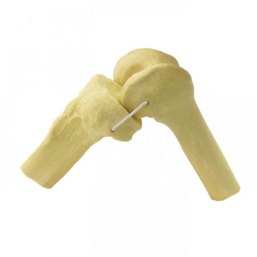 Anatomisches Modell / Knochen - 2040ERL - Nacional Ossos - Knie / für orthopädische Chirurgie / für die Ausbildung