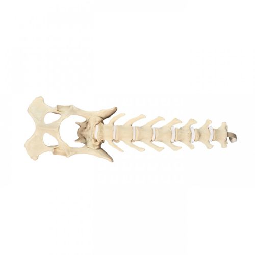 Anatomisches Modell / Becken - AV413 - Nacional Ossos - Lendenwirbelsäule / chirurgisch / für die Ausbildung