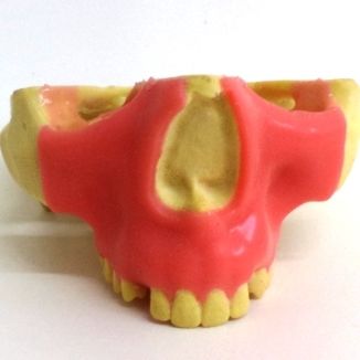 Anatomisches Modell / Oberkiefer - 4402-01GT - Nacional Ossos - Nebenhöhle / gingival / Chirurgie