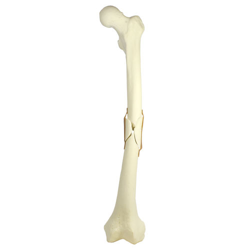 Anatomisches Modell / Knochen - 9703 - Nacional Ossos - Oberschenkelknochen / für orthopädische Chirurgie / Ausbildung