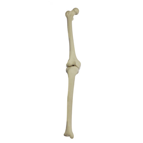 Anatomisches Modell / Knochen - 2040BDESP - Nacional Ossos - Knie / Tibia / Oberschenkelknochen