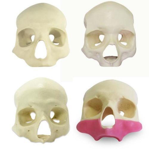 Anatomisches Schädelmodell - 9014G ALL-ON-4 - Nacional Ossos - Nebenhöhle / gingival / für Implantologie