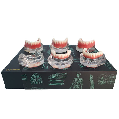 Anatomisches Modell / Unterkiefer - 9768 - Nacional Ossos - Gebiss / Oberkiefer / für Zahnbehandlung