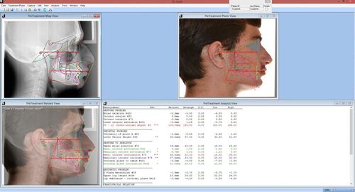 Fernröntgen-Software - Dr. Ceph - For Your Imaging Technologies - für medizinische Bildgebung / orthodontisch / OP