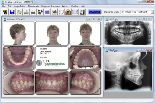 Fernröntgen-Software - Dr. View - For Your Imaging Technologies - orthodontisch