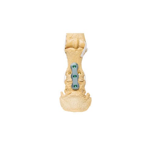 Knochenplatte für Hunde - ALPS® PIP - KYON - Mehrzweck / proximale