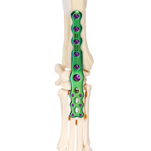 Veterinär-Knochenplatte / für Carpaltunnel - ALPS® FUSE  - KYON - für Sprunggelenk / seitlich / medial