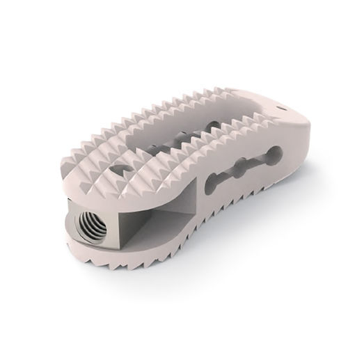 Thorako-lumbales Zwischenwirbelimplantat - Twisty  - NORMMED Medical Devices - transforaminaler Zugang / aus PEEK